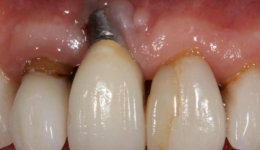 Yes, But It's Not Simple