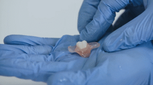 For Young People: Marcus's Story