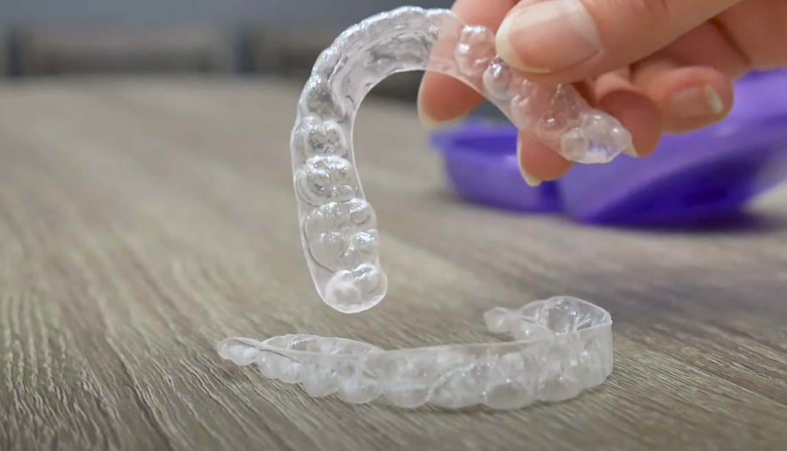 Why Does a Retainer Become Loose?