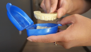 why is my retainer loose